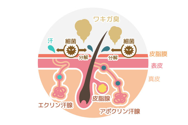ワキガ 対策