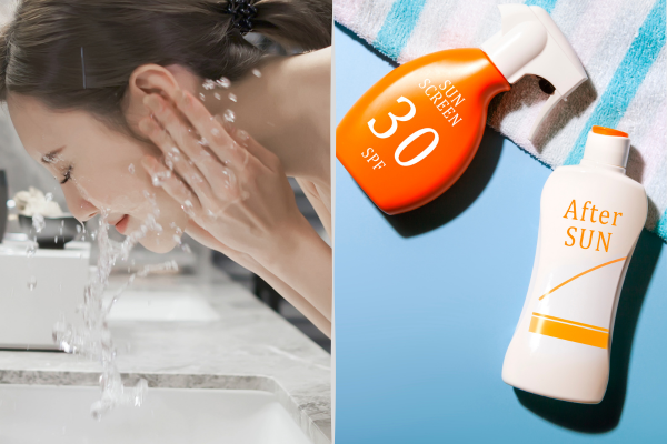 肝斑 シミ 違い