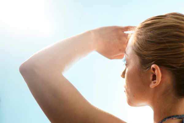 肝斑 シミ 違い