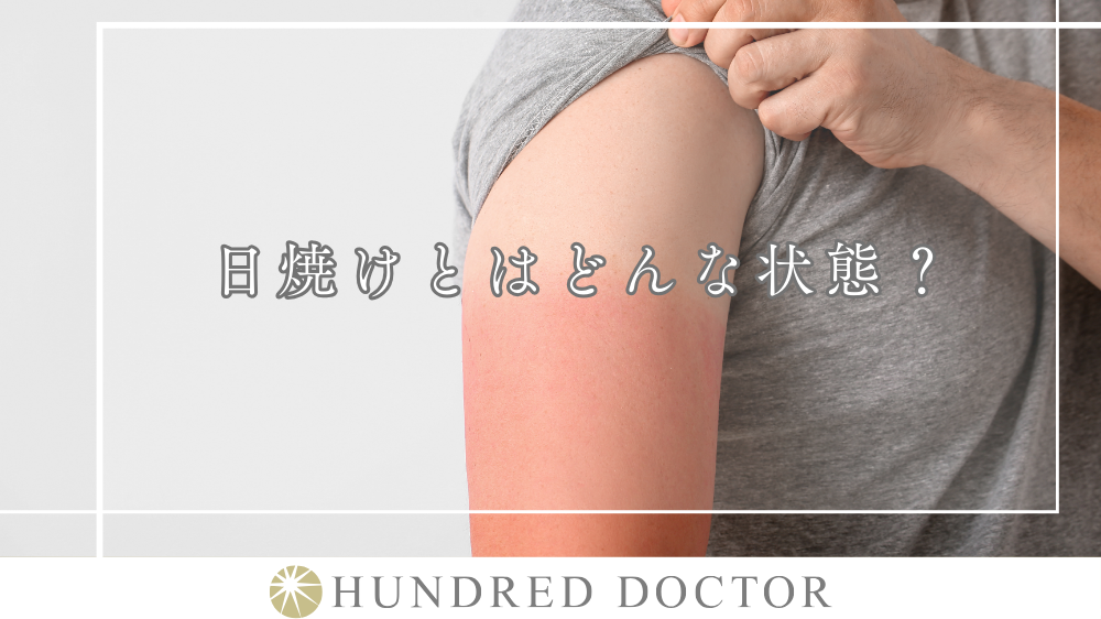 日焼けのしすぎ