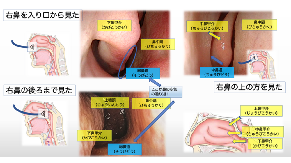 鼻詰まりの原因は？日常でできる解消方法や長引く場合の対処法を紹介