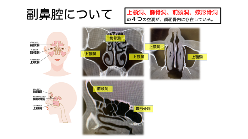 鼻詰まりの原因は？日常でできる解消方法や長引く場合の対処法を紹介