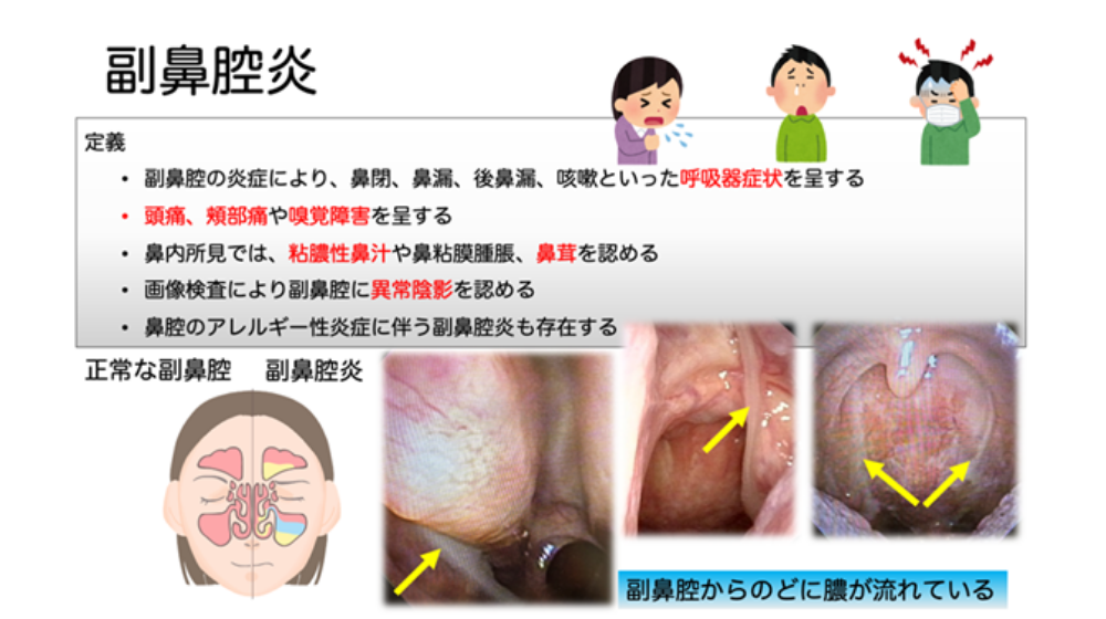 鼻詰まりの原因は？日常でできる解消方法や長引く場合の対処法を紹介