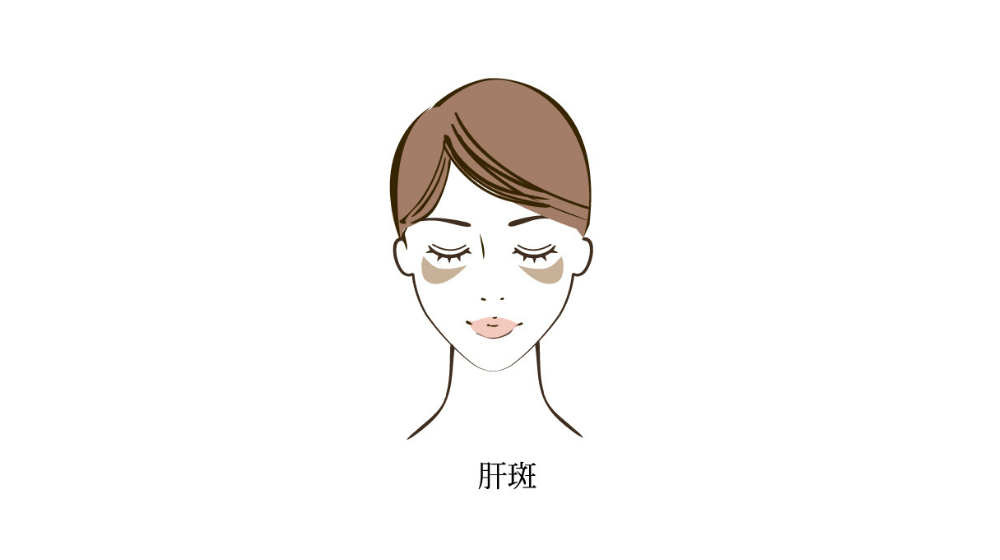 シミができやすい人の特徴
