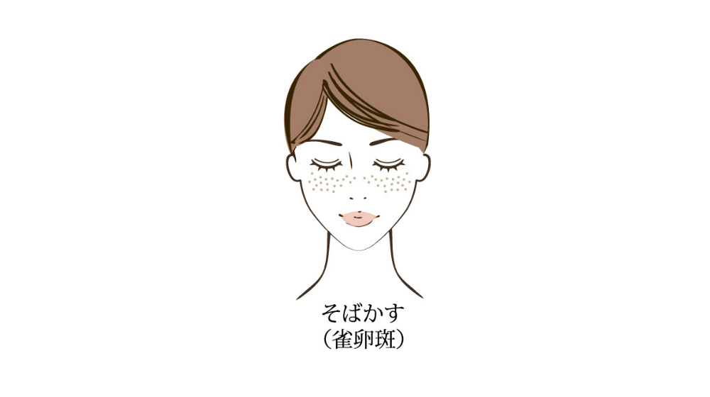 シミができやすい人の特徴