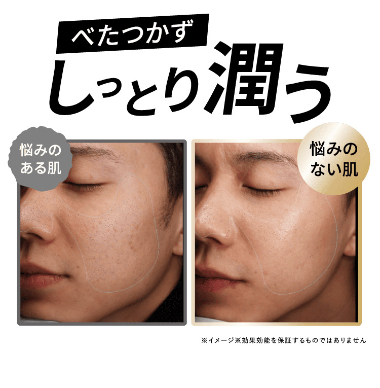 ベタつかずしっとり潤う　悩みのある肌から悩みのない肌への変化 ビフォーアフター比較画像