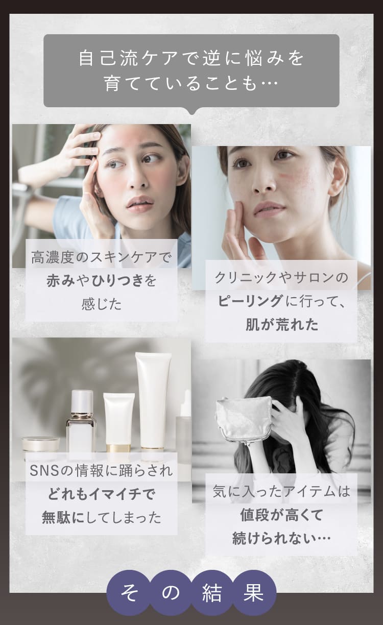 自己流ケアで逆に悩みを育てていることも 高濃度スキンケアで赤みやひりつき・クリニックやサロンのピーリングで肌荒れ・SNS情報に踊らされイマイチで無駄・値段が高くて続けられない