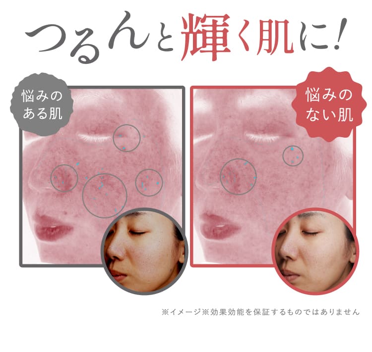 つるんと輝く肌に！悩みのある肌から悩みのない肌への変化 ビフォーアフター比較画像