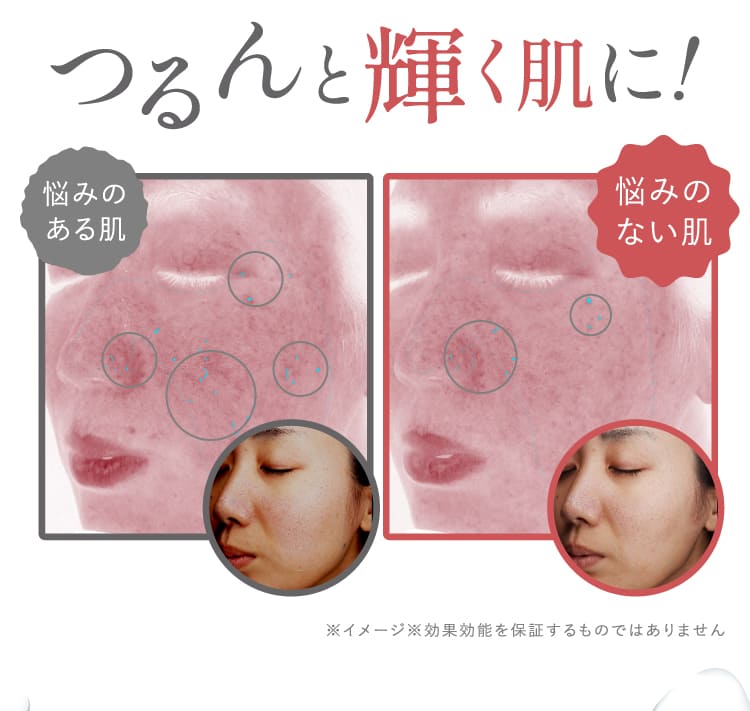 つるんと輝く肌に！悩みのある肌から悩みのない肌への変化 ビフォーアフター比較画像