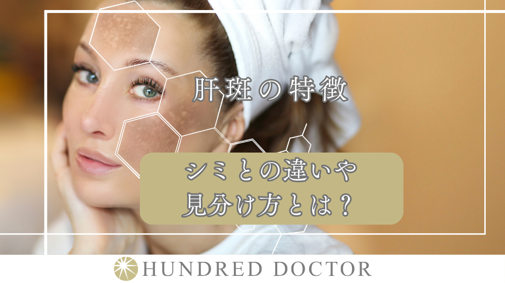 肝斑の特徴｜シミとの違いや見分け方とは？