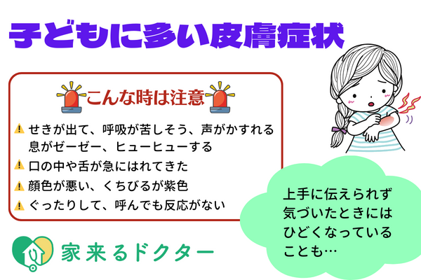 子どもに多い皮膚症状