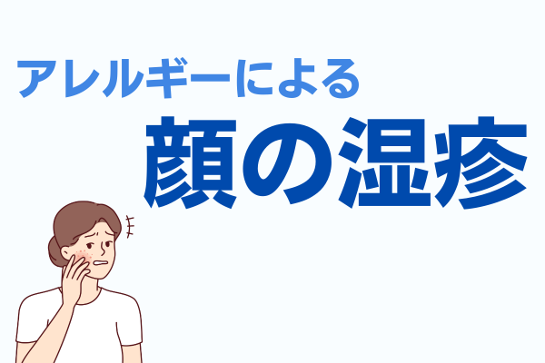 アレルギー顔湿疹