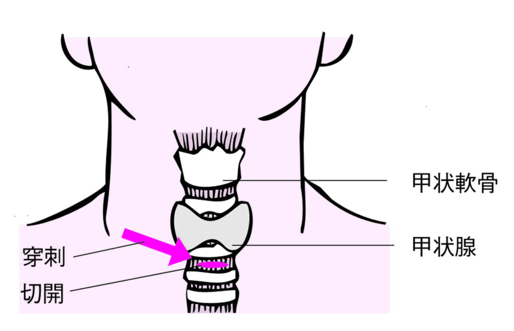 【知っておきたい】甲状腺が原因で考えられる病気のまとめ