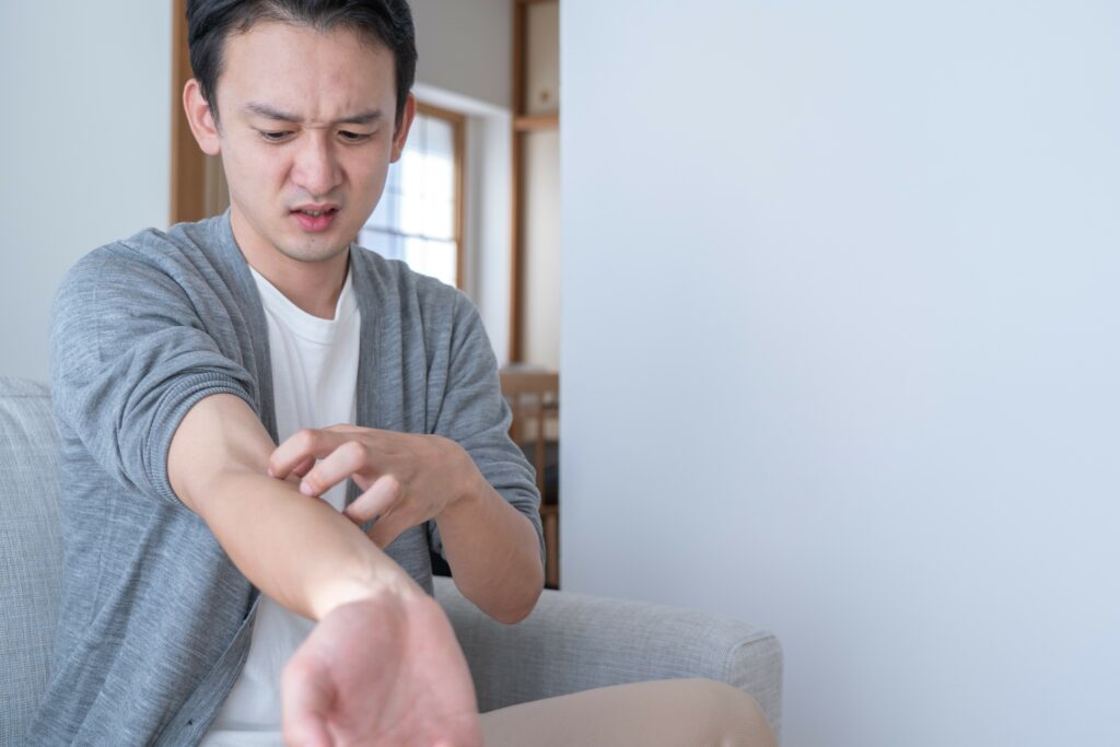 いんきんたむし(股部白癬)はうつるのか？原因や湿疹との見分け方について解説