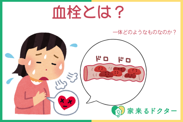 血栓とは?原因・症状・予防法・できやすい人の特徴を紹介 | 家来るドクター